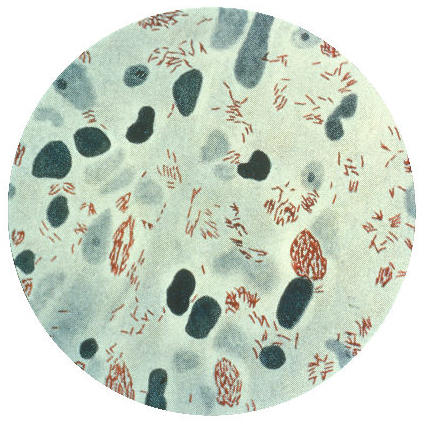 나균(Mycobacterium leprae)의 전자 현미경 사진. 사진 출처=위키피디아